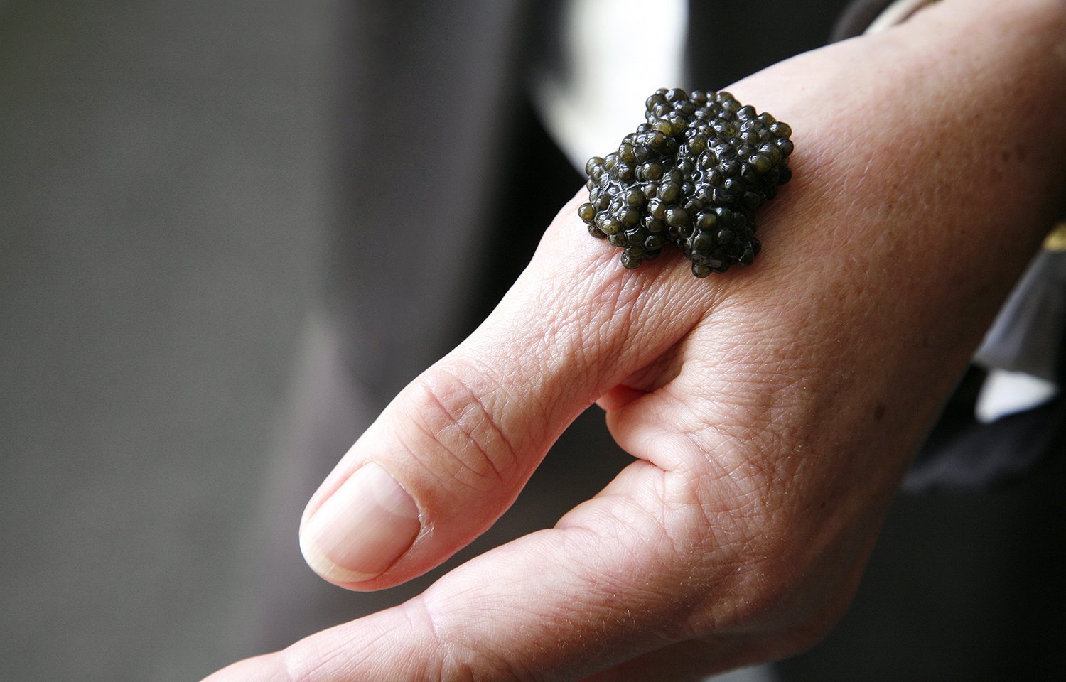 Caviar bump on hand
